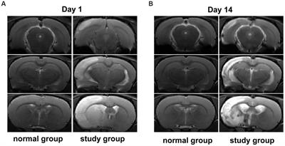 Untargeted metabonomic analysis of a cerebral stroke model in rats: a study based on UPLC–MS/MS